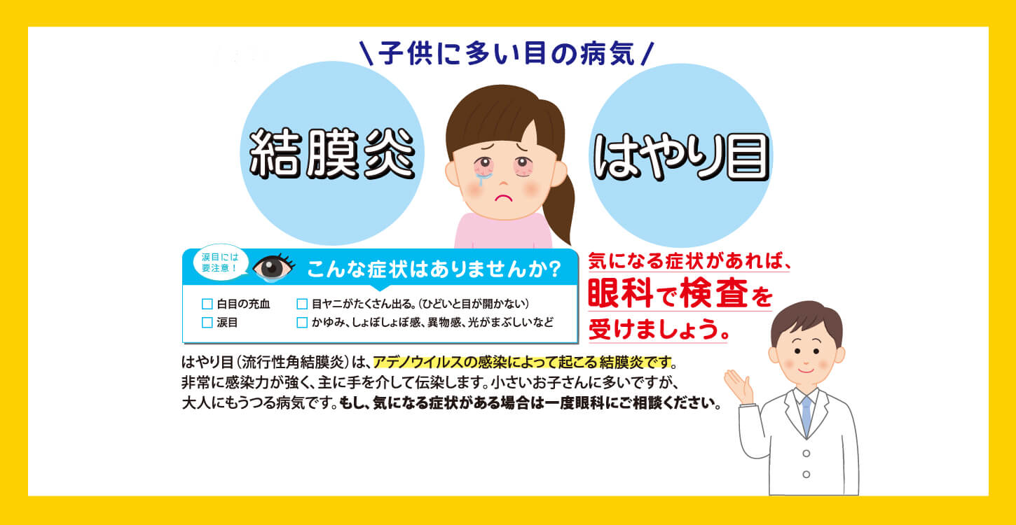 結膜炎、はやり目 気になる症状があれば眼科で検査を受けましょう